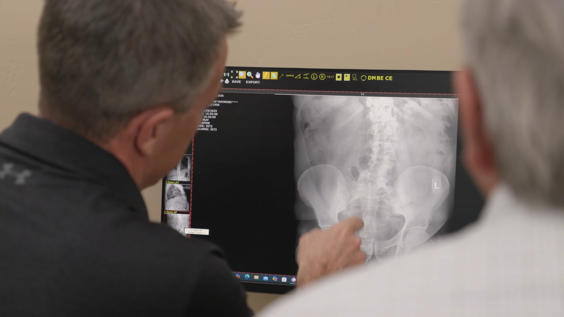 Chiropractor reviewing spine X-ray with patient