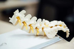 An anatomical model of a human spine, showing white vertebrae and yellow nerve roots, resting on a light surface with blurred background.